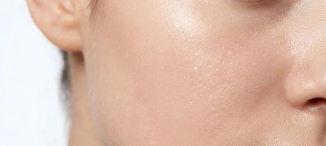 Gros plan d'une peau visiblement hydratée et lissée après application d'acide hyaluronique
