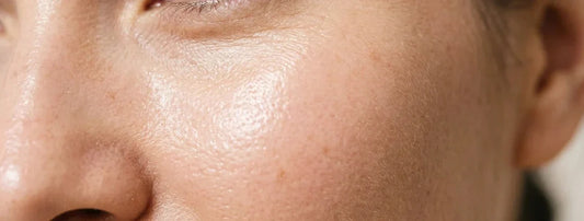 Acide Hyaluronique et Peau Sensible : L'Hydratant Idéal