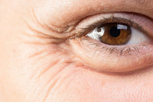 Vieillissement cutané : comprendre ses mécanismes pour mieux le ralentir