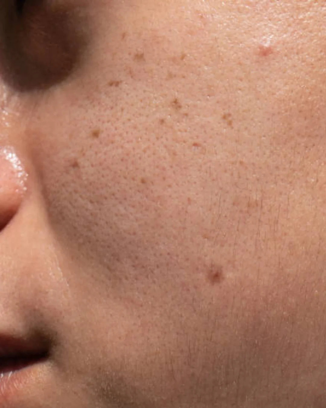 Gros plan de profil d’une joue avec des pores visibles et de petites taches/grains de beauté.