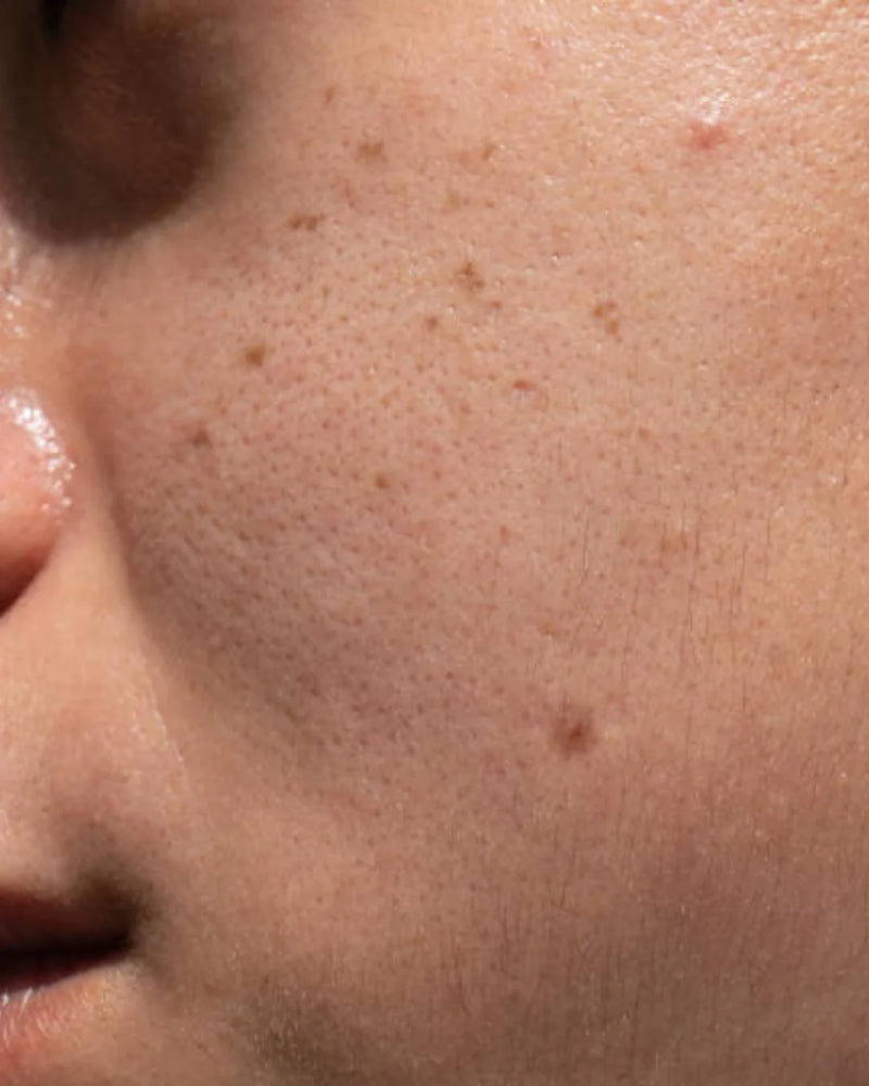 Gros plan de profil d’une joue avec des pores visibles et de petites taches/grains de beauté.